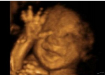 Woman Says Aborting Her Baby “Made Me a Better Person”