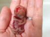 Mother Who Miscarried Shares Photo of 11-Week Son as Testament to Personhood of Unborn