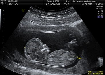 Idaho Posts List of Locations With Free Ultrasounds in Effort to Save Unborn Babies