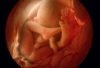 New York Wants to Overturn Late-Term Abortion Ban to Kill Unborn Babies After 24 Weeks