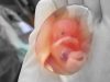 U.S. university under fire for illegal use of foetal tissue in research