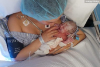Pregnant Woman’s Water Broke at 23 Weeks But Doctors Saved Baby and Delivered Her 12 Weeks Later