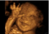 There Have Now Been 59 Million Unborn Children Killed by Abortion in the United States