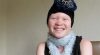 African Albino Finds Acceptance in Christ after Being Shunned by Her Own People