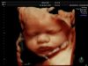 Abortion Clinic Staffer: An Aborted Baby “is Shaped Like a Baby But Not a Person”