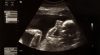Fascinating Scientific Discovery Shows Unborn Baby’s Cells Repair Mom’s Organs