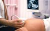 New Jersey Legislators Push Bill Banning Late-Term Abortions After 20 Weeks
