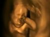 Ultrasound Technician: “There is Nothing More Heart-Wrenching” Than Seeing Babies Who Will be Aborted