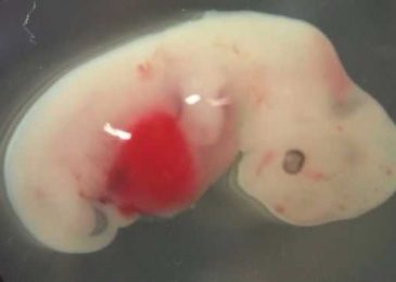Researchers Experiment Creation of Human-Pig ‘Chimera Embryos’ to Address Shortage of Donor Organs