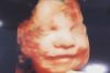 Woman Rejects Abortion After Seeing Her Baby’s Heart Beat on an Ultrasound