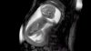 New Technology Allows Parents to See Their Unborn Babies in Crystal Clear Video