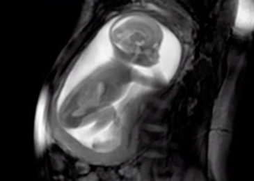 New Technology Allows Parents to See Their Unborn Babies in Crystal Clear Video