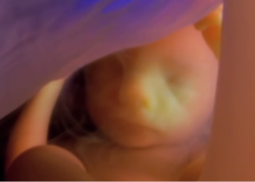 Why Do Unborn Babies Matter? Just Because They Are